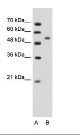 PLIN1 / Perilipin Antibody - A: Marker, B: Jurkat Cell Lysate.  This image was taken for the unconjugated form of this product. Other forms have not been tested.