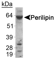 PLIN1 / Perilipin Antibody - Detection of Perilipin in human liver samples using antibody at 2ug/ml.  This image was taken for the unconjugated form of this product. Other forms have not been tested.