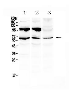 PLIN1 / Perilipin Antibody - Western blot - Anti-Perilipin A Picoband Antibody