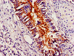 PLIN1 / Perilipin Antibody - Immunohistochemistry image of paraffin-embedded human lung tissue at a dilution of 1:100