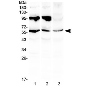 PLIN1 / Perilipin Antibody - Western blot testing of 1) rat liver, 2) mouse liver and 3) human HepG2 lysate with PLIN1 antibody at 0.5ug/ml. Predicted molecular weight ~56 kDa.