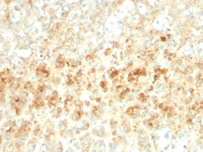 PLIN2 / ADFP / Adipophilin Antibody - Formalin-fixed, paraffin-embedded human Adrenal Gland stained with Adipophilin Recombinant Rabbit Monoclonal Antibody (ADFP/2755R).