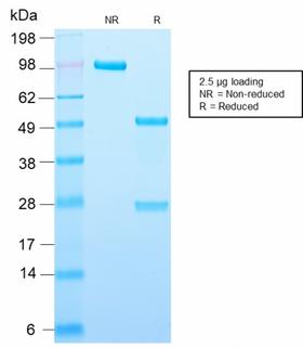PLIN2 / ADFP / Adipophilin Antibody - SDS-PAGE Analysis Purified Adipophilin Recombinant Rabbit Monoclonal Antibody (ADFP/2755R). Confirmation of Purity and Integrity of Antibody.