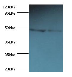 PLIN2 / ADFP / Adipophilin Antibody - Western blot. All lanes: PLIN2 antibody at 4 ug/ml. Lane 1: HepG2 whole cell lysate. Lane 2: HeLa whole cell lysate. Secondary antibody: Goat polyclonal to rabbit at 1:10000 dilution. Predicted band size: 48 kDa. Observed band size: 48 kDa Immunohistochemistry.