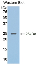 PLIN2 / ADFP / Adipophilin Antibody - Western blot of PLIN2 / ADFP / Adipophilin antibody.