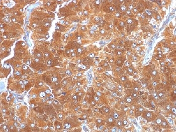 PLIN2 / ADFP / Adipophilin Antibody - IHC testing of FFPE human adrenal tissue with ADRP antibody (clone ADFP/1494). Required HIER: steam sections in pH6, 10mM citrate buffer for 10-20 min.