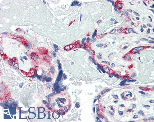 PLIN2 / ADFP / Adipophilin Antibody - Anti-Adipophilin antibody IHC of human placenta. Immunohistochemistry of formalin-fixed, paraffin-embedded tissue after heat-induced antigen retrieval. Antibody concentration 5 ug/ml.  This image was taken for the unconjugated form of this product. Other forms have not been tested.