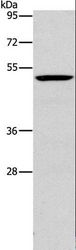 PLIN2 / ADFP / Adipophilin Antibody - Western blot analysis of Mouse liver tissue, using PLIN2 Polyclonal Antibody at dilution of 1:600.
