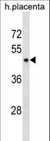 PLIN3 / M6PRBP1 / TIP47 Antibody - PLIN3 Antibody western blot of human placenta tissue lysates (35 ug/lane). The PLIN3 antibody detected the PLIN3 protein (arrow).