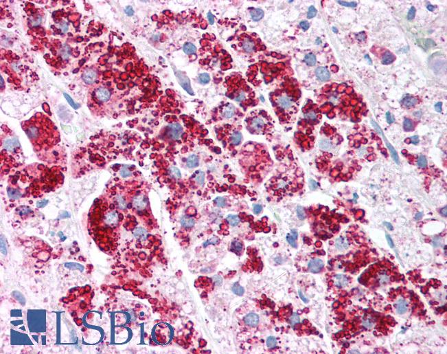 PLIN3 / M6PRBP1 / TIP47 Antibody - Anti-PLIN3 / M6PRBP1 antibody IHC of human adrenal. Immunohistochemistry of formalin-fixed, paraffin-embedded tissue after heat-induced antigen retrieval. Antibody concentration 5 ug/ml.  This image was taken for the unconjugated form of this product. Other forms have not been tested.
