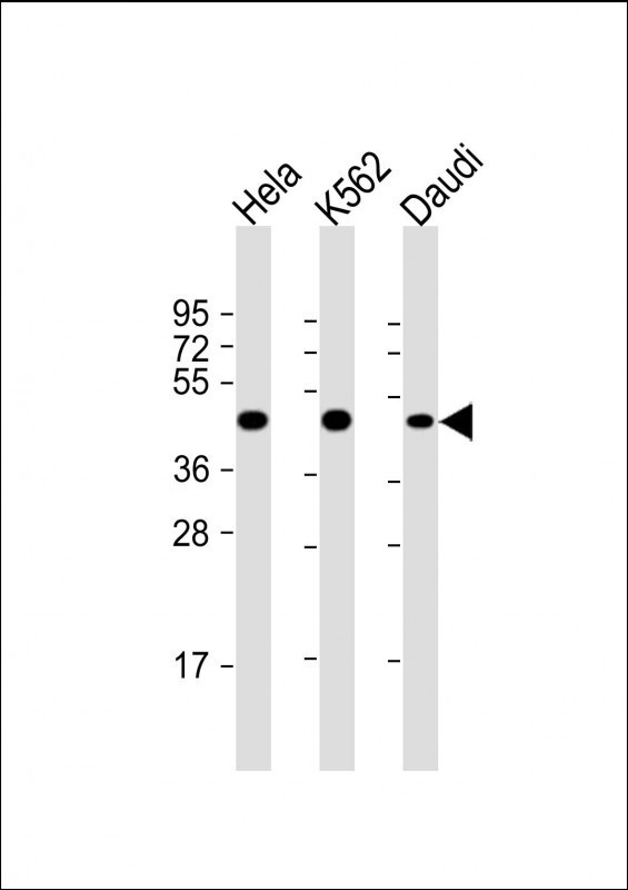 PLIN3 / M6PRBP1 / TIP47 Antibody - All lanes: Anti-PLIN3 Antibody at 1:2000 dilution Lane 1: Hela whole cell lysate Lane 2: K562 whole cell lysate Lane 3: Daudi whole cell lysate Lysates/proteins at 20 µg per lane. Secondary Goat Anti-mouse IgG, (H+L), Peroxidase conjugated at 1/10000 dilution. Predicted band size: 47 kDa Blocking/Dilution buffer: 5% NFDM/TBST.