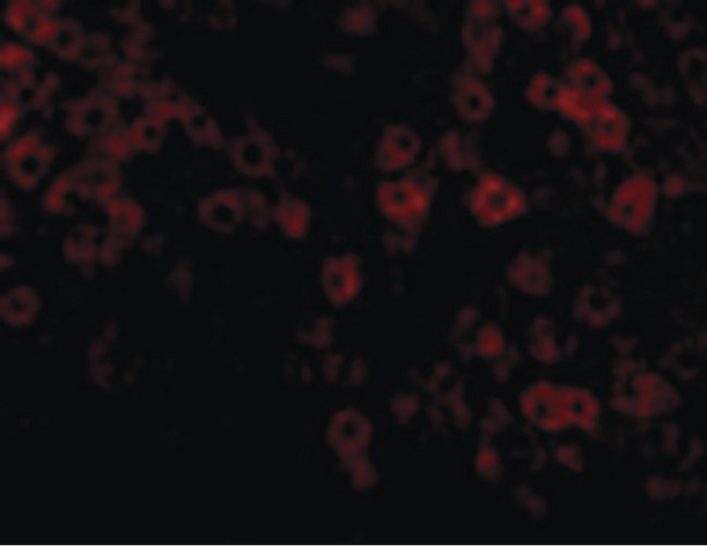 PLIN3 / M6PRBP1 / TIP47 Antibody - Immunofluorescence of TIP47 in Rat Liver cells with TIP47 antibody at 20 ug/ml.
