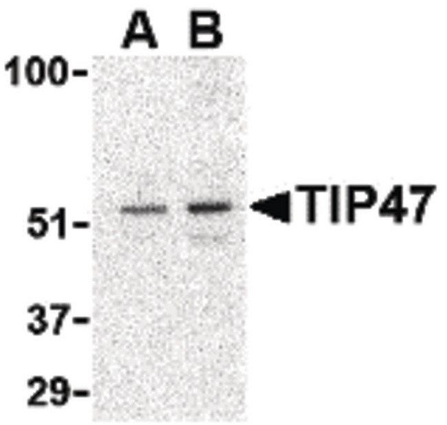 PLIN3 / M6PRBP1 / TIP47 Antibody - Western blot of TIP47 in Daudi cell lysate with TIP47 antibody at (A) 0.5 and (B) 1 ug/ml.