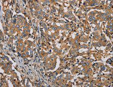 PLIN3 / M6PRBP1 / TIP47 Antibody - Immunohistochemistry of paraffin-embedded Human brain using PLIN3 Polyclonal Antibody at dilution of 1:50.