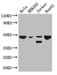 PLIN3 / M6PRBP1 / TIP47 Antibody - Positive WB detected in:Hela whole cell lysate,HEK293 whole cell lysate,Jurkat whole cell lysate,HepG2 whole cell lysate;All lanes: PLIN3 antibody at 3ug/ml;Secondary;Goat polyclonal to rabbit IgG at 1/50000 dilution;Predicted band size: 48,29,47,46 kDa;Observed band size: 48,45 kDa;
