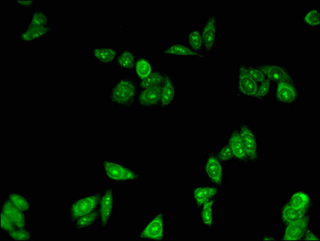 PLIN3 / M6PRBP1 / TIP47 Antibody - Immunofluorescent analysis of HepG2 cells using PLIN3 Antibody at a dilution of 1:100 and Alexa Fluor 488-congugated AffiniPure Goat Anti-Rabbit IgG(H+L)