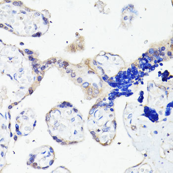 PLIN3 / M6PRBP1 / TIP47 Antibody - Immunohistochemistry of paraffin-embedded human placenta using PLIN3 antibody at dilution of 1:100 (40x lens).