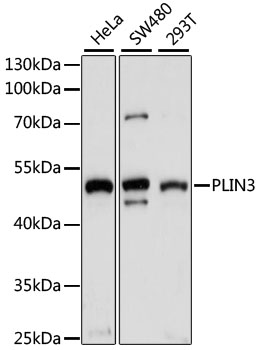 PLIN3 / M6PRBP1 / TIP47 Antibody - Western blot analysis of extracts of various cell lines, using PLIN3 antibody at 1:1000 dilution. The secondary antibody used was an HRP Goat Anti-Rabbit IgG (H+L) at 1:10000 dilution. Lysates were loaded 25ug per lane and 3% nonfat dry milk in TBST was used for blocking. An ECL Kit was used for detection and the exposure time was 30s.