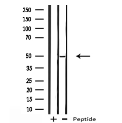 PLIN3 / M6PRBP1 / TIP47 Antibody - Western blot analysis on HeLa cell lysates using TIP47 antibody