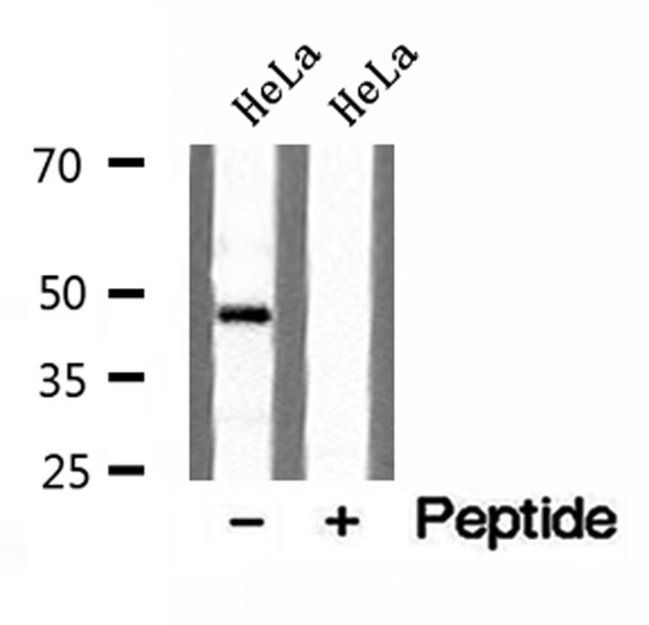 PLIN3 / M6PRBP1 / TIP47 Antibody - Western blot analysis of extracts of HeLa cells using TIP47 antibody.