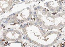 PLIN3 / M6PRBP1 / TIP47 Antibody - 1:100 staining mouse kidney tissue by IHC-P. The sample was formaldehyde fixed and a heat mediated antigen retrieval step in citrate buffer was performed. The sample was then blocked and incubated with the antibody for 1.5 hours at 22°C. An HRP conjugated goat anti-rabbit antibody was used as the secondary.