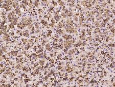 PLIN3 / M6PRBP1 / TIP47 Antibody - Immunochemical staining of human PLIN3 in human adrenal gland with rabbit polyclonal antibody at 1:2000 dilution, formalin-fixed paraffin embedded sections.