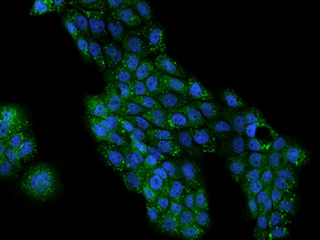 PLIN3 / M6PRBP1 / TIP47 Antibody - Immunofluorescence staining of M6PRBP1 in A431 cells. Cells were fixed with 4% PFA, permeabilzed with 0.1% Triton X-100 in PBS, blocked with 10% serum, and incubated with rabbit anti-Human M6PRBP1 polyclonal antibody (dilution ratio 1:200) at 4°C overnight. Then cells were stained with the Alexa Fluor 488-conjugated Goat Anti-rabbit IgG secondary antibody (green) and counterstained with DAPI (blue). Positive staining was localized to Cytoplasm.