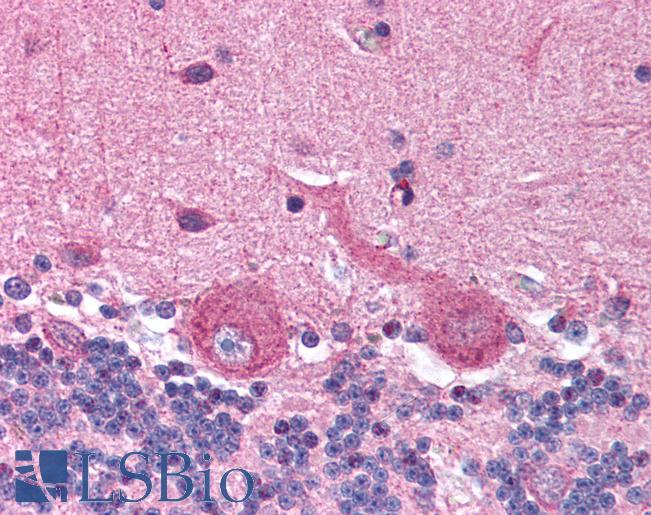 PLIN3 / M6PRBP1 / TIP47 Antibody - Anti-PLIN3 / M6PRBP1 antibody IHC of human brain, cerebellum. Immunohistochemistry of formalin-fixed, paraffin-embedded tissue after heat-induced antigen retrieval. Antibody concentration 5 ug/ml.  This image was taken for the unconjugated form of this product. Other forms have not been tested.