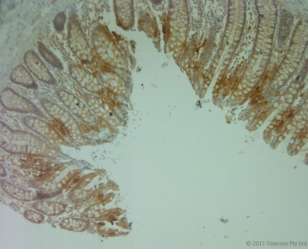 PLIN4 / S3-12 Antibody - Rabbit antibody to Perilipin 4 (1050-1100). IHC on paraffin sections of human large intestine tissue using Rabbit antibody to Perilipin 4 (1050-1100). HIER: 1 mM EDTA, pH 8 for 20 min using Thermo PT Module. Blocking: 0.2% LFDM in TBST filtered through a 0.2 micron filter. Detection was done using Novolink HRP polymer from Leica following manufacturer's instructions. Primary antibody: dilution 1:1000, incubated 30 min at RT (using Autostainer. Sections were counterstained with Harris Hematoxylin.