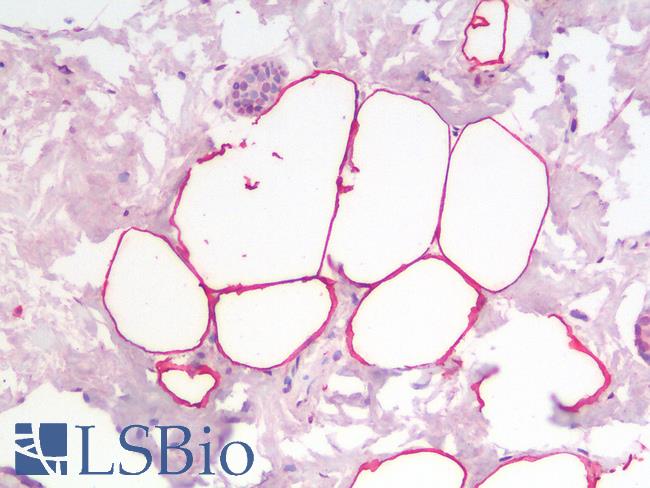 PLIN4 / S3-12 Antibody - Human Breast Adipose Tissue: Formalin-Fixed, Paraffin-Embedded (FFPE)