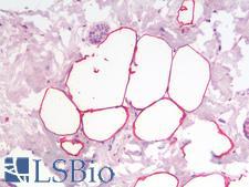 PLIN4 / S3-12 Antibody - Human Breast Adipose Tissue: Formalin-Fixed, Paraffin-Embedded (FFPE)