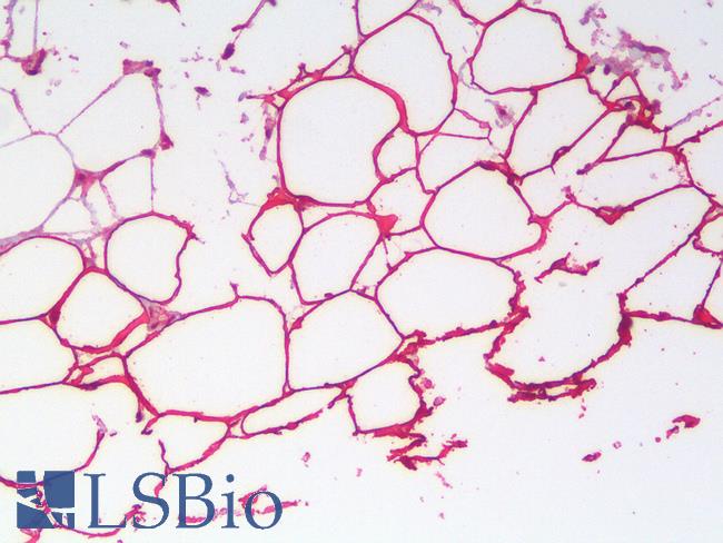 PLIN4 / S3-12 Antibody - Human Small Intestine Adipose Tissue: Formalin-Fixed, Paraffin-Embedded (FFPE)