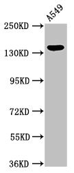 PLIN4 / S3-12 Antibody - Western Blot Positive WB detected in:A549 whole cell lysate All Lanes:PLIN4 antibody at 2.7µg/ml Secondary Goat polyclonal to rabbit IgG at 1/50000 dilution Predicted band size: 135,141 KDa Observed band size: 135 KDa