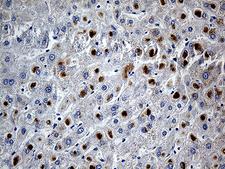 PLIN5 / OXPAT / LSDP5 Antibody - Immunohistochemical staining of paraffin-embedded Human liver tissue within the normal limits using anti-PLIN5 mouse monoclonal antibody. (Heat-induced epitope retrieval by 1mM EDTA in 10mM Tris buffer. (pH8.5) at 120°C for 3 min. (1:500)