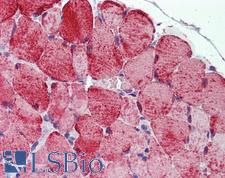 PLIN5 / OXPAT / LSDP5 Antibody - Anti-PLIN5 / LSDP5 antibody IHC of mouse skeletal muscle. Immunohistochemistry of formalin-fixed, paraffin-embedded tissue after heat-induced antigen retrieval. Antibody concentration 5 ug/ml.  This image was taken for the unconjugated form of this product. Other forms have not been tested.