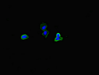 PLIN5 / OXPAT / LSDP5 Antibody - Immunofluorescent analysis of HepG2 cells diluted at 1:100 and Alexa Fluor 488-congugated AffiniPure Goat Anti-Rabbit IgG(H+L)