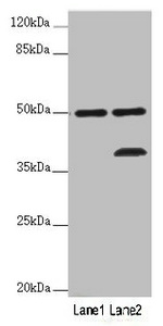 PLIN5 / OXPAT / LSDP5 Antibody - Western blot All Lanes :PLIN5 antibody at 2 ug/ml Lane 1 : Mouse kidney tissue Lane 2 : Mouse brain tissue Secondary Goat polyclonal to rabbit IgG at 1/10000 dilution Predicted band size: 51 kDa Observed band size: 51,36 kDa