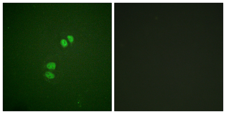 PLK1 / PLK-1 Antibody - Immunofluorescence analysis of A549 cells, using PLK1 Antibody. The picture on the right is blocked with the synthesized peptide.