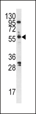PLK1 / PLK-1 Antibody - Western blot of anti-PLK antibody in A375 cell lysate. PLK (arrow) was detected using purified antibody. Secondary HRP-anti-rabbit was used for signal visualization with chemiluminescence.