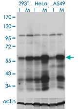 PLK1 / PLK-1 Antibody - Western blot analysis of PLK1 in extracts from 293T, HeLa and A549 cell using anti-PLK1 monoclonal antibody.