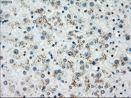 PLK1 / PLK-1 Antibody - Immunohistochemical staining of paraffin-embedded liver tissue using anti-PLK1 mouse monoclonal antibody. (Dilution 1:50).