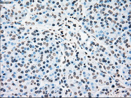 PLK1 / PLK-1 Antibody - Immunohistochemical staining of paraffin-embedded pancreas tissue using anti-PLK1 mouse monoclonal antibody. (Dilution 1:50).
