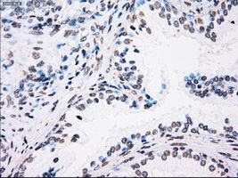 PLK1 / PLK-1 Antibody - Immunohistochemical staining of paraffin-embedded prostate tissue using anti-PLK1 mouse monoclonal antibody. (Dilution 1:50).