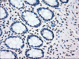 PLK1 / PLK-1 Antibody - IHC of paraffin-embedded colon tissue using anti-PLK1 mouse monoclonal antibody. (Dilution 1:50).