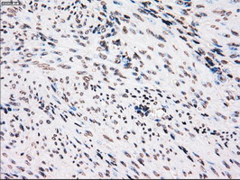 PLK1 / PLK-1 Antibody - IHC of paraffin-embedded endometrium tissue using anti-PLK1 mouse monoclonal antibody. (Dilution 1:50).