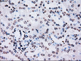 PLK1 / PLK-1 Antibody - IHC of paraffin-embedded Kidney tissue using anti-PLK1 mouse monoclonal antibody. (Dilution 1:50).