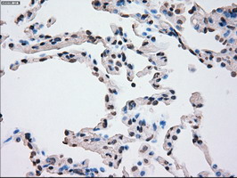 PLK1 / PLK-1 Antibody - IHC of paraffin-embedded lung tissue using anti-PLK1 mouse monoclonal antibody. (Dilution 1:50).
