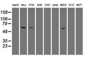 PLK1 / PLK-1 Antibody - Western blot of extracts (35 ug) from 9 different cell lines by using anti-PLK1 monoclonal antibody.