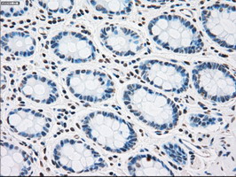 PLK1 / PLK-1 Antibody - IHC of paraffin-embedded colon tissue using anti-PLK1 mouse monoclonal antibody. (Dilution 1:50).