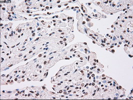 PLK1 / PLK-1 Antibody - IHC of paraffin-embedded lung tissue using anti-PLK1 mouse monoclonal antibody. (Dilution 1:50).